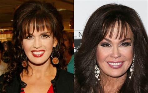 Marie Osmond: Before and After